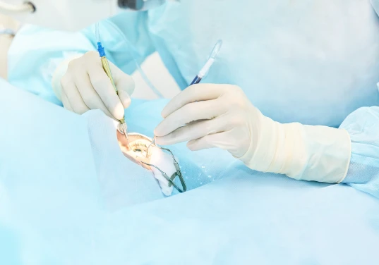 cataract surgery & cataract Treatment