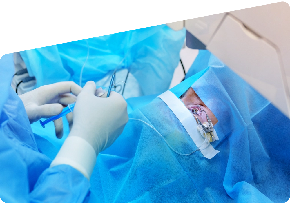 LASIK Procedure: Steps, Preparation and Recovery