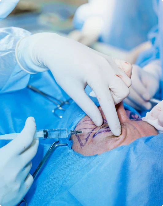 eyelid surgery dubai